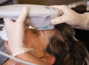 Strahlung des Gesichts mit Ultherapy: Schonende Behandlung mit Ultraschall!
